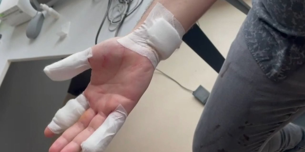 Büyükçekmece'de Veliyi Hastanelik Eden Kavga