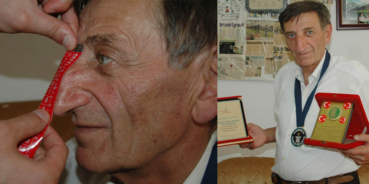 Dünyanın en uzun burunlu adamı hayatını kaybetti