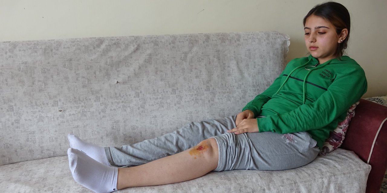 Liseli Özge, Köpeklerin Saldırısında Yaralandı