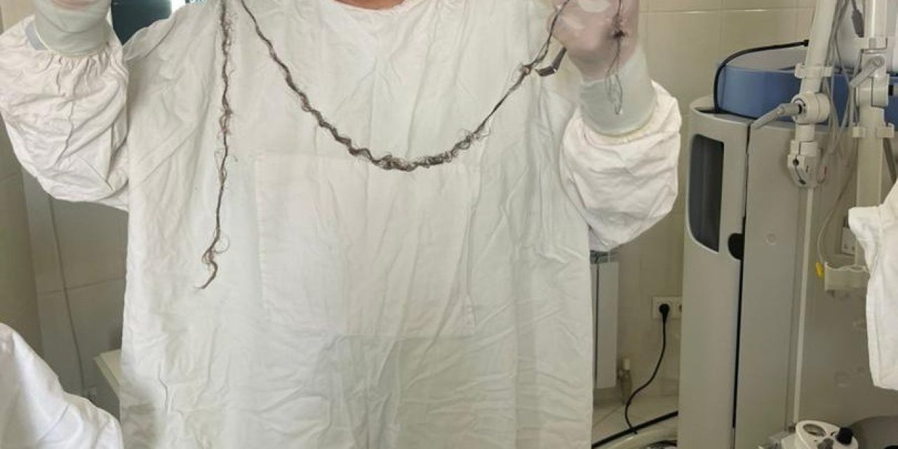 Kırgızistanlı Çocuğun Beyninden Saç Çıktı