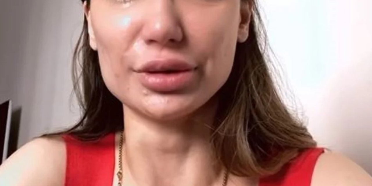 Emre Aşık’ın Eski Eşi Yağmur Sarnıç İntihar Girişiminde Bulundu