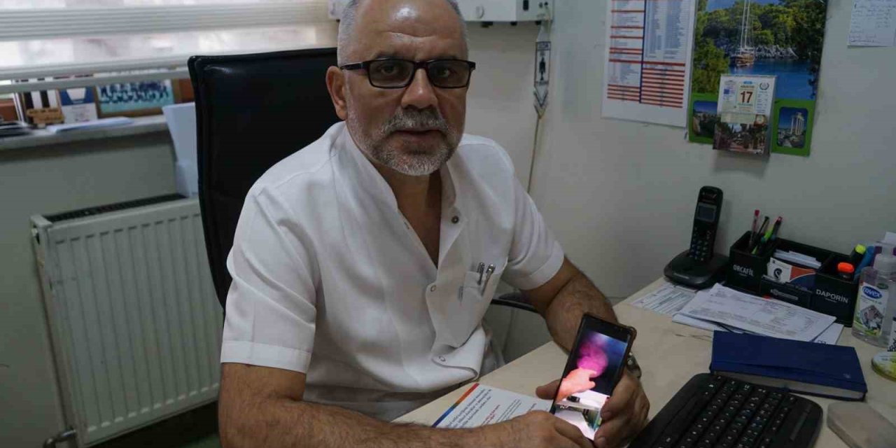 Kastamonu’da Prostat Büyümesi İçin Endoskopik Rezum Ameliyatı