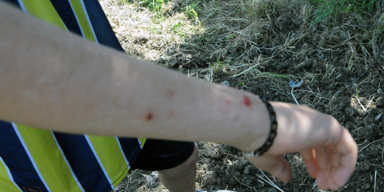 Hatay'da Havalar Isındı, Konteynerlerde Sinek Ve Haşere Sorunu Başladı