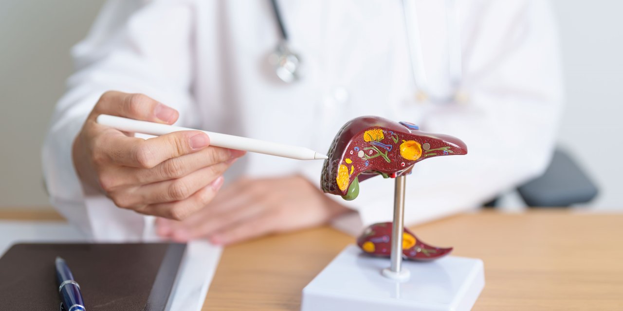 Cerrahi Şansı Olmayan Karaciğer Tümörlerinde Radyoembolizasyon Yaşam Beklentisini Yükseltiyor