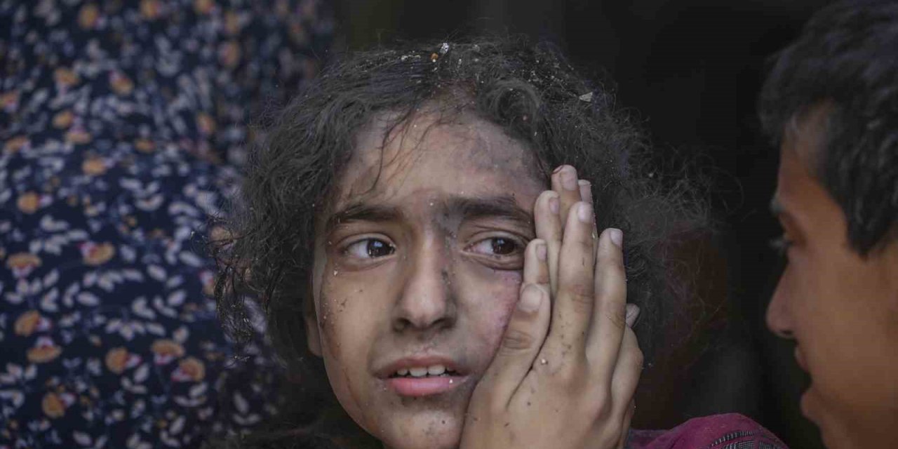 Gazze’de Can Kaybı 34 Bin 535’e Yükseldi