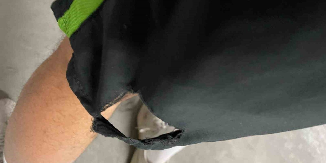 Kağıthane’de Yarışmaya Hazırlanan Sporcuyu Başıboş Köpek Isırdı