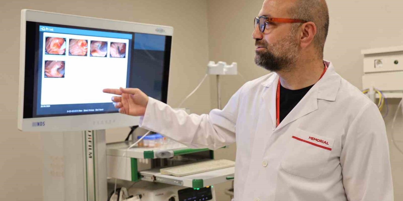 Tanısı Konulamayan Hastadan Kolanjiyoskop Yöntemiyle Dokudan Biyopsi Alındı