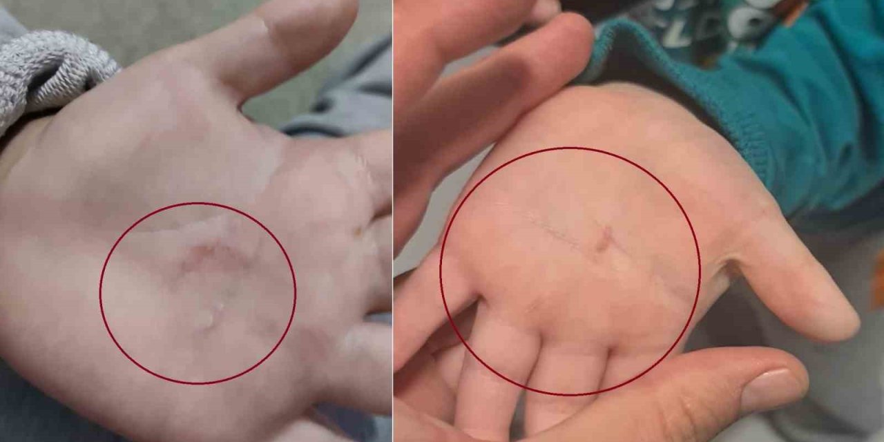 Bandırma Belediyesi’nin Kreşinde 4 Yaşındaki Çocuğa Şiddet İddiası