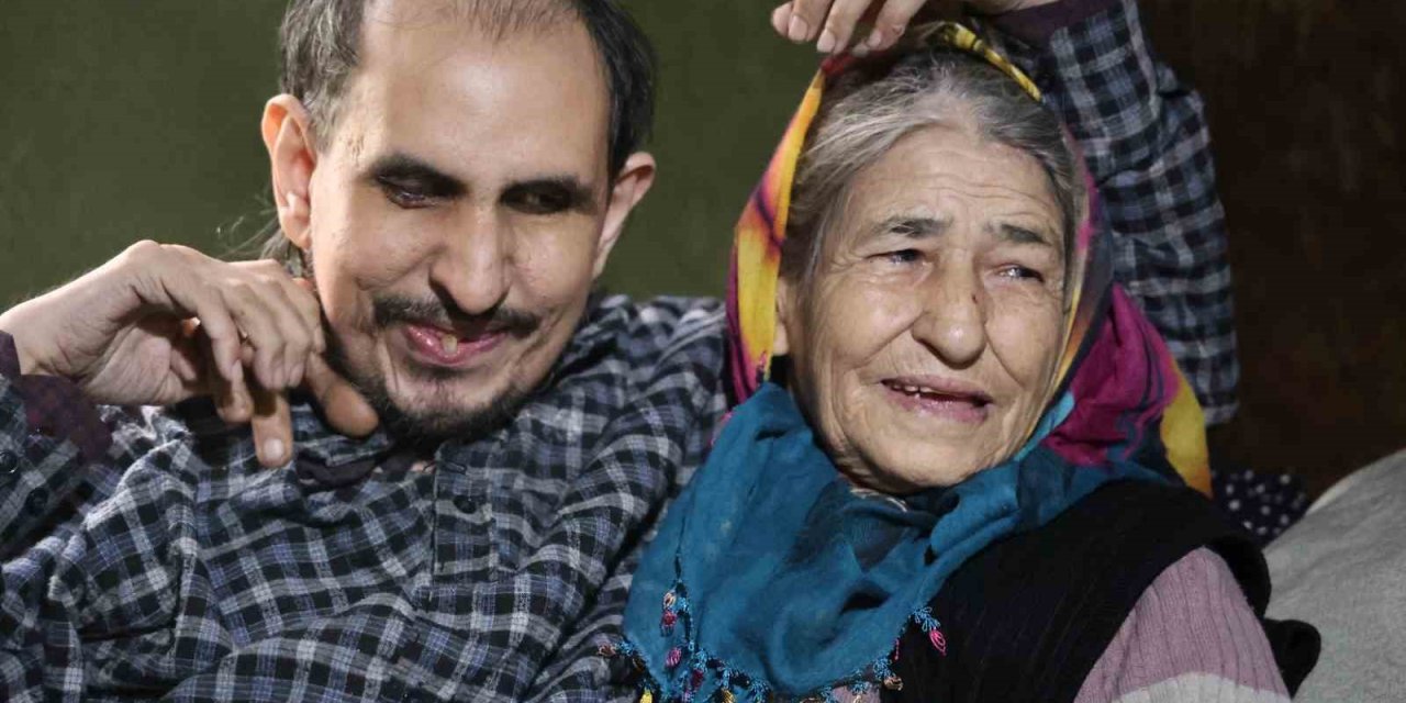 Hayatta Kalan Tek Oğluna 40 Yıldır Bebek Gibi Bakıyor