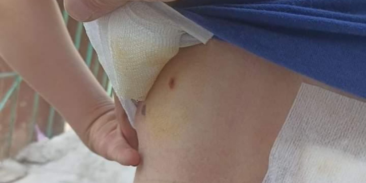 Diyarbakır’da 8 Yaşındaki Çocuk Sokak Köpeklerinin Saldırısında Yaralandı