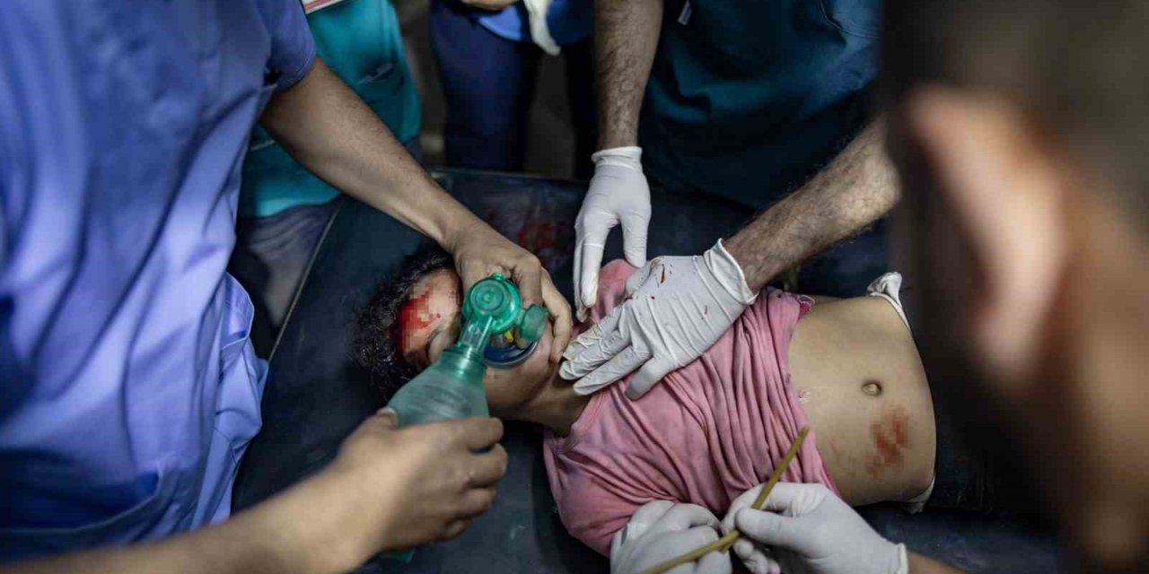 Gazze’de Can Kaybı 35 Bin 562’ye Yükseldi