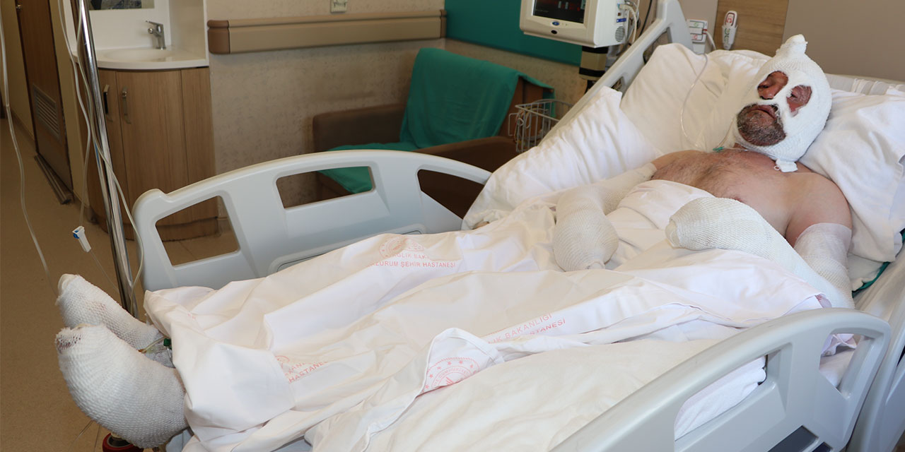 Rize'de sobanın yanında unuttuğu benzin bidonu canından ediyordu