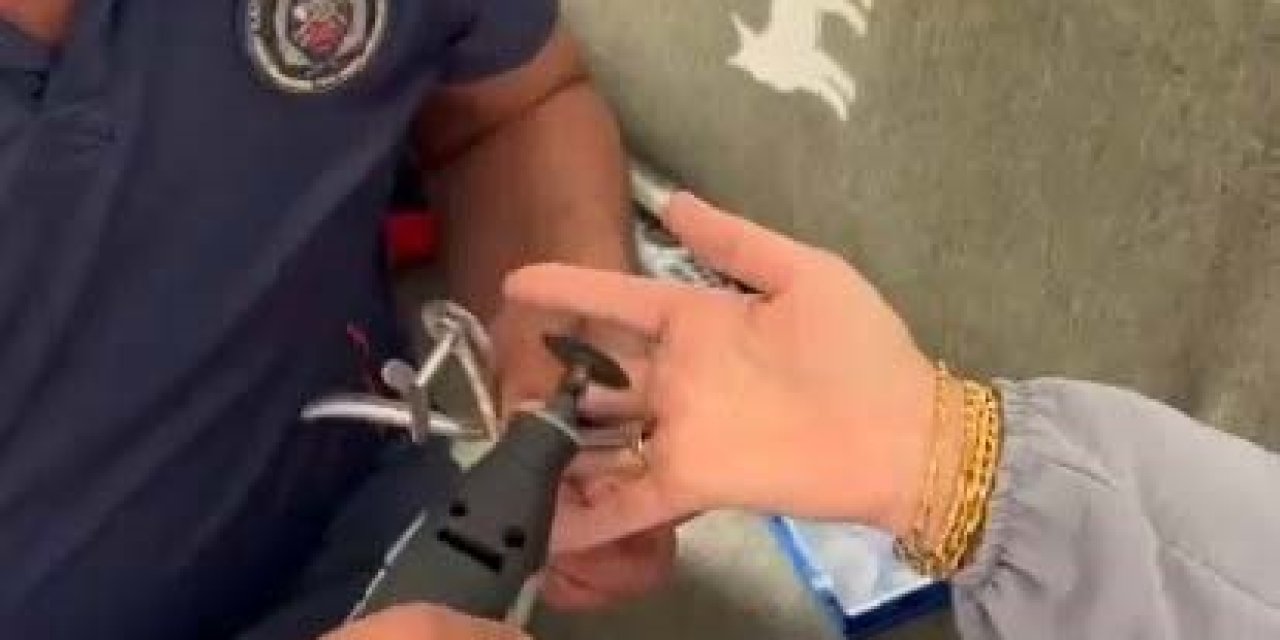 Sıkışan Yüzük İtfaiye Ekipleri Tarafından Çıkarıldı