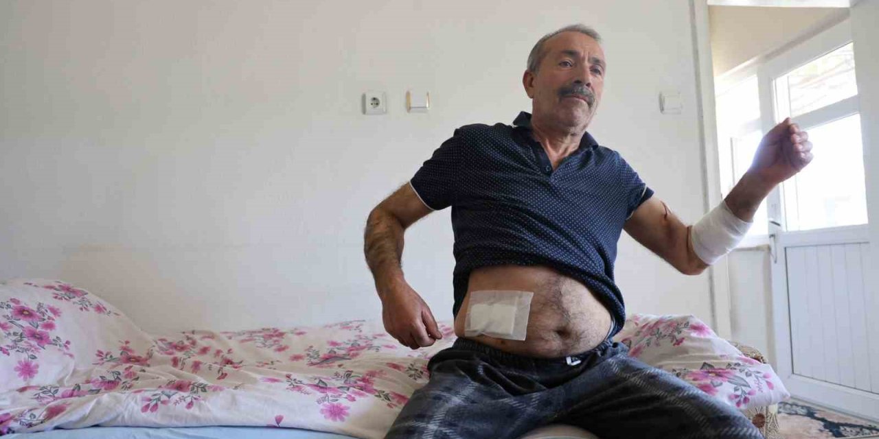 Köpeklerin Saldırdığı Adam Dehşeti Yaşadı