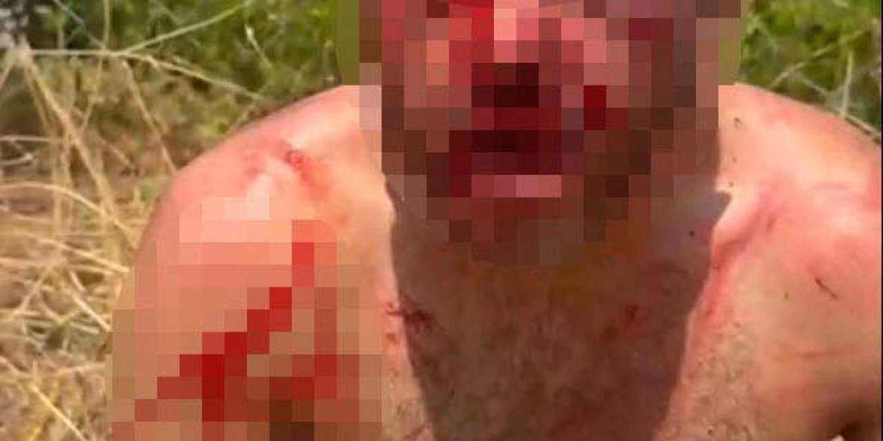 Cinsel İstismar Şüphelisini Dövüp, Jandarmaya Teslim Ettiler