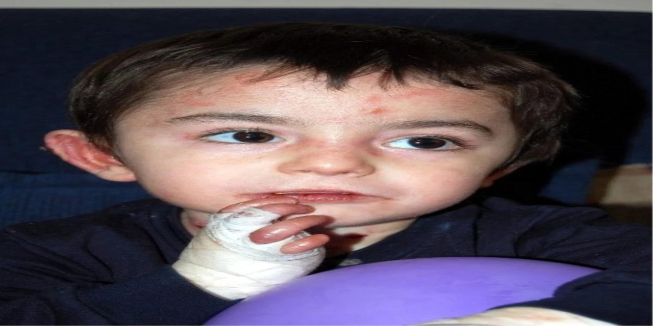 13 Yaşındaki Mert, Kelebek Hastalığından Öldü