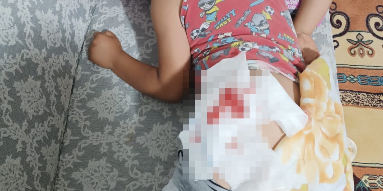 8 Yaşındaki Miraç, Başıboş Köpeğin Saldırısında Yaralandı