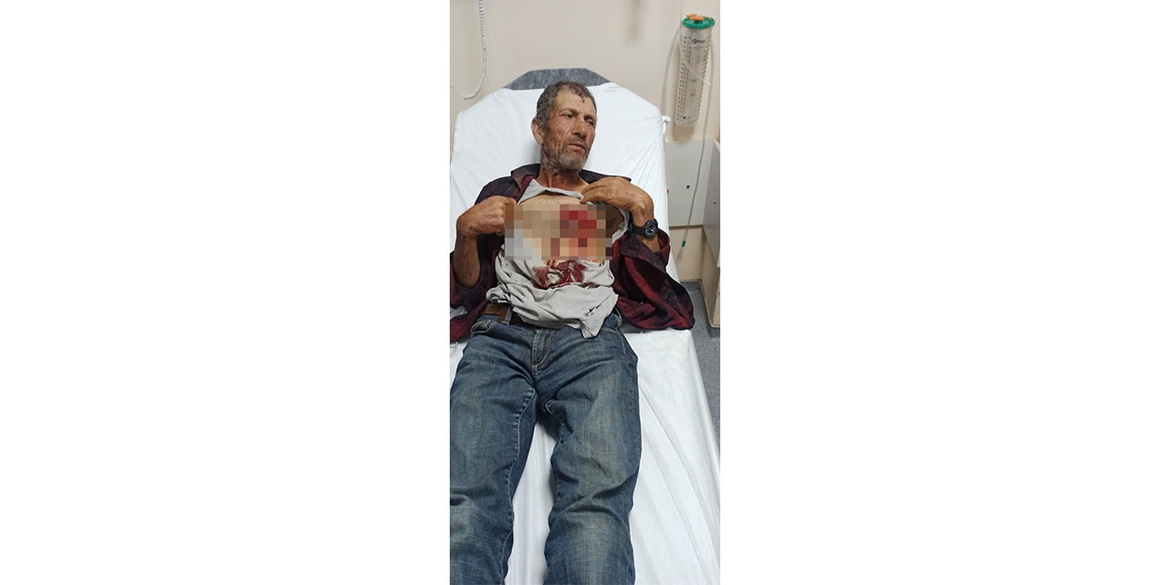 Hayvanlarını otlatırken domuz saldırısında yaralandı