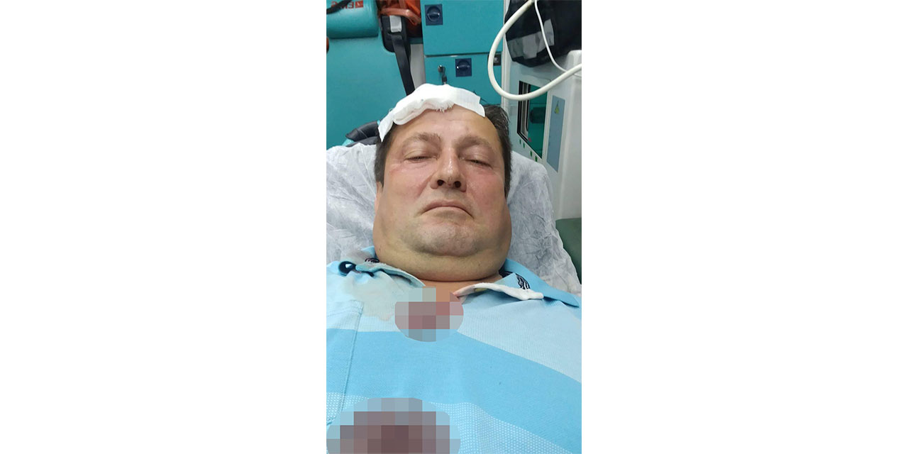 Evinin balkonunda otururken başına isabet eden 'yorgun mermi' ile yaralandı