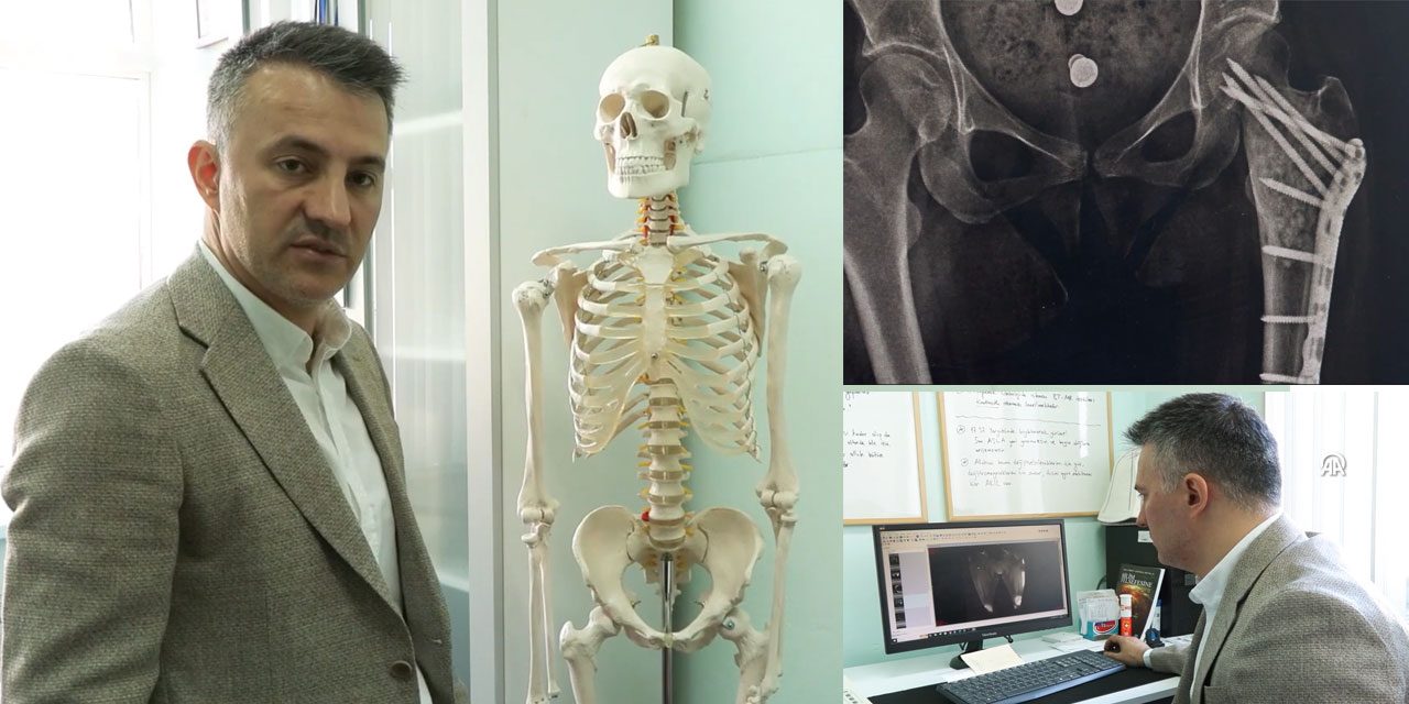 Ortopedik Tümörler Tedavi Edilmezse Ciddi Sonuçlar Doğurabiliyor