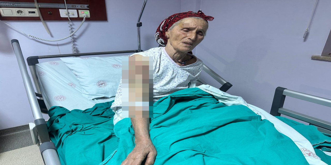 65 yaşındaki kadına 7 köpek saldırdı; vücuduna 50 dikiş atıldı
