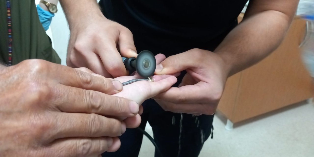 Parmağına Sıkışan Yüzüğü İtfaiye Görevlisi Keserek Çıkardı