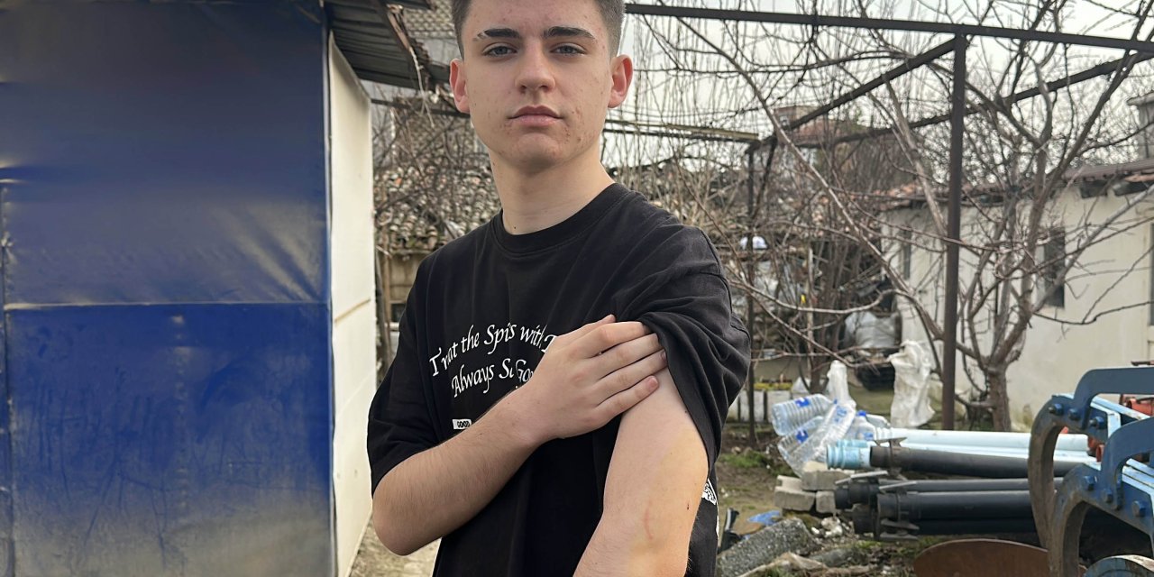 Okul yolunda köpek saldırdı; lise öğrencisi kolundan yaralandı