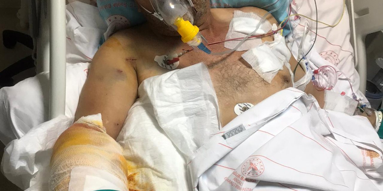 Eski Muhtarın Vurduğu Ağabeyine, 300'e Yakın Saçma İsabet Etti