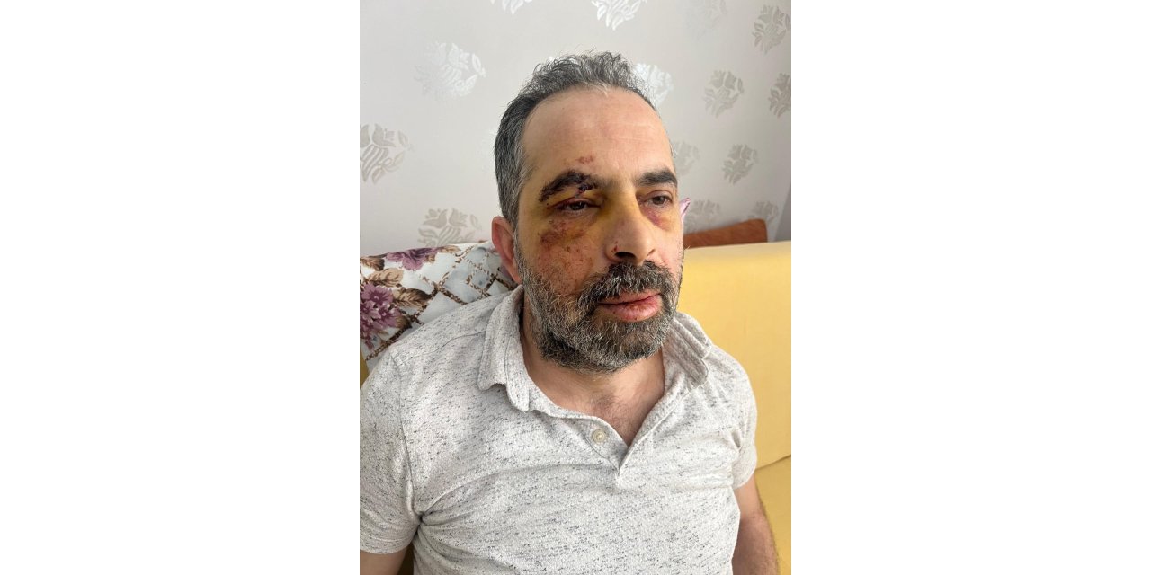 Köpeklerden kaçarken bisikletten düşüp, yaralandı