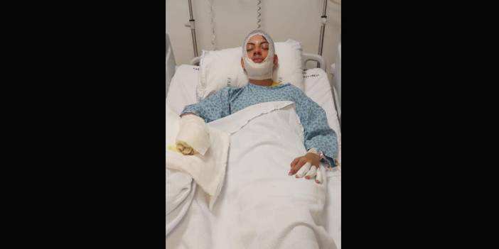 Ateşe benzin döktü, facianın eşiğinden döndü