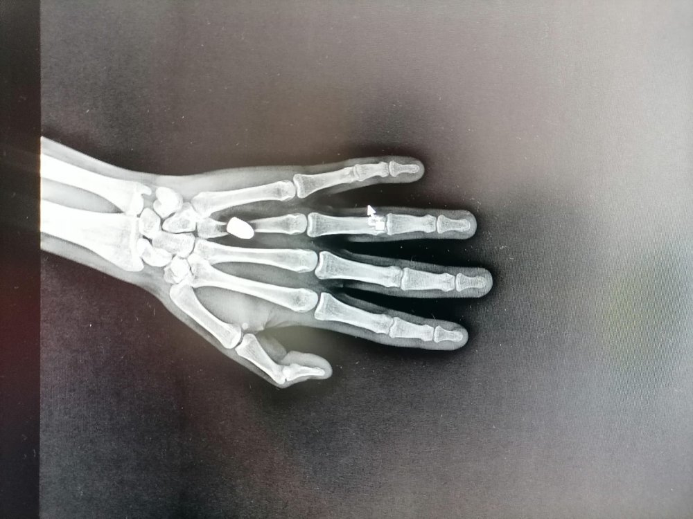 Magandalar Ölüme Doymadı; Trabzon'da 1 Yılda 3 Can Kaybı, 9 Yaralanma