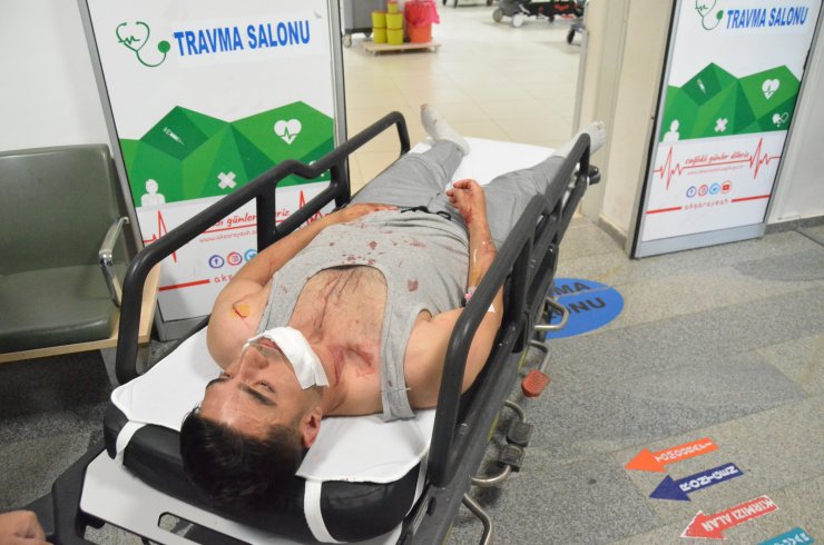 Otobüste Ayağına Bastığı Yolcuyu Darbedip, Palayla Yaraladı