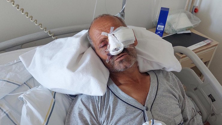 Elektrikli Testere Yüzünü Kesti; Gözünü Kaybetme Riski Var