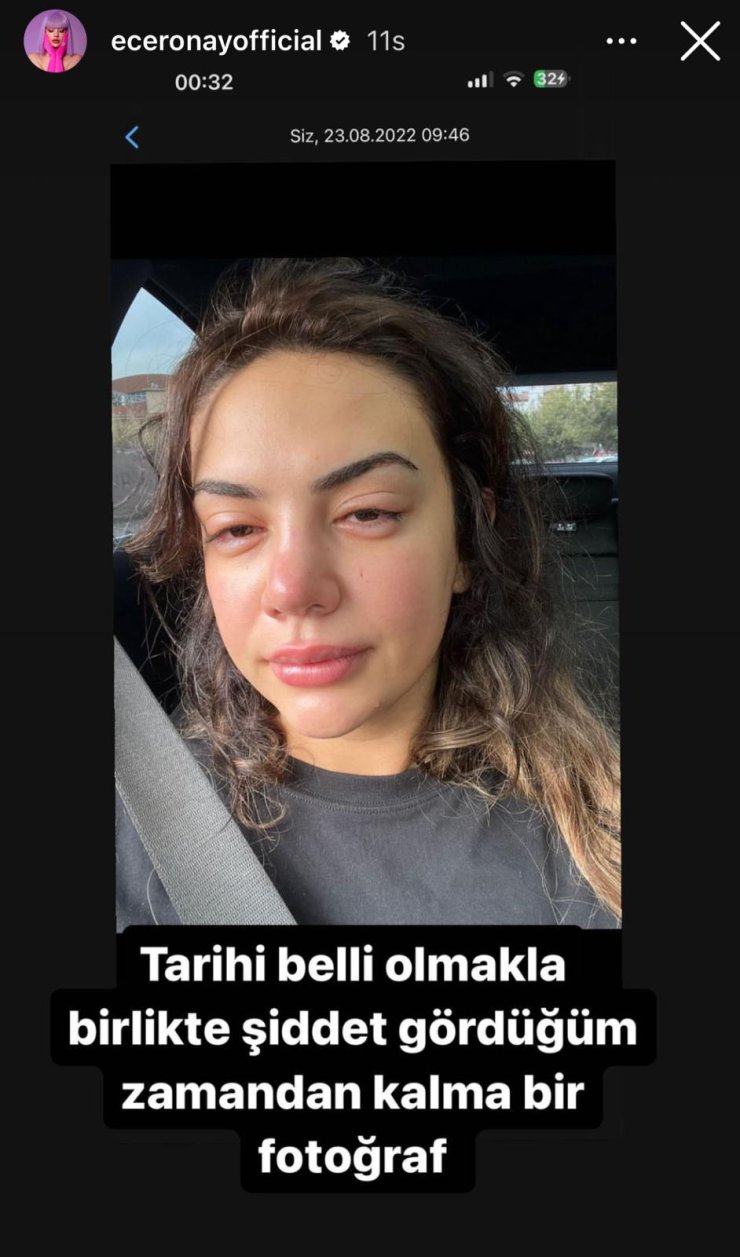 Ece Ronay Sosyal Medyadan Yardım İstedi: "Defalarca Ölüm Tehdidi Aldım"