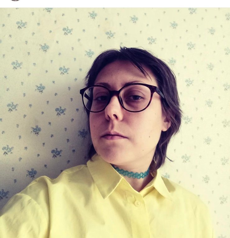 Sevgilisinin Cam Parçasıyla Bacağını Kestiği Rus Kadın, Öldü