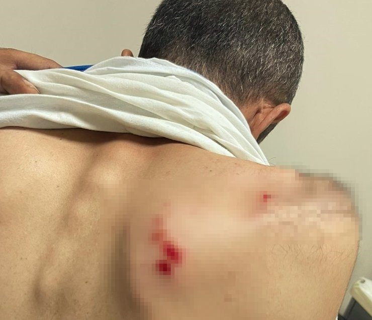 Kaçak Elektrik Kontrolü Yapan Ekibe Odun Ve Yumruklu Saldırı: 2 Yaralı