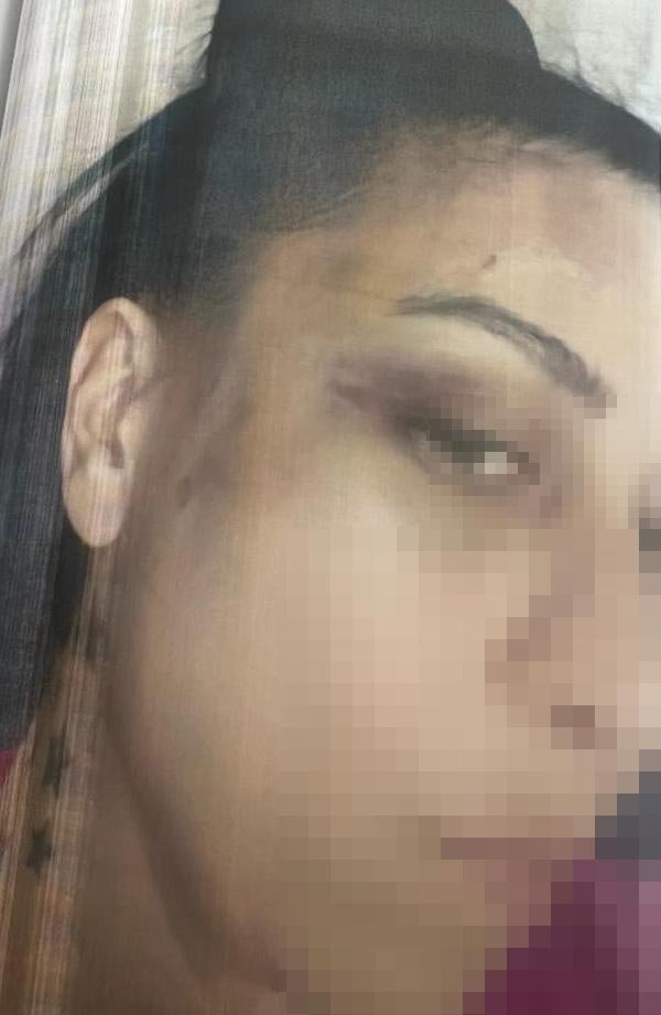 Çıplak Fotoğrafla Şantaj Kavgasında Erkek Arkadaşını Bıçaklayan Sanığa 11 Yıl Hapis Talebi