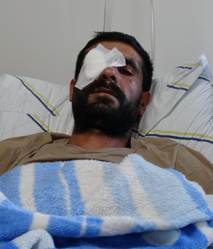 Pusu Kuran Hasımları Av Tüfeğiyle Vurdu, Bir Gözünü Kaybetti