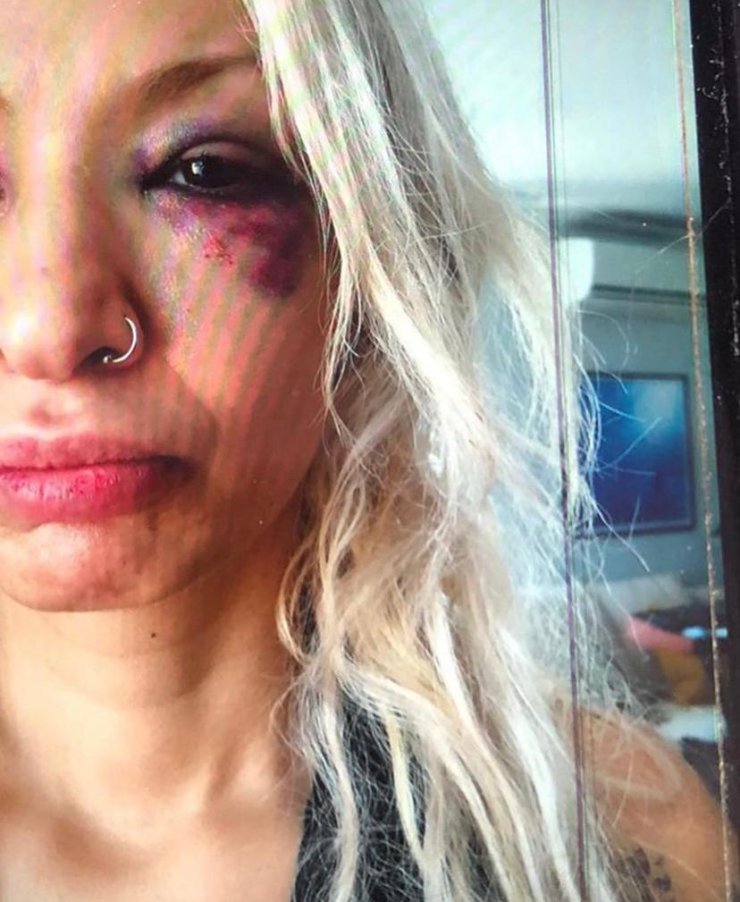 Yüzyüzeyken Konuşuruz'un Gitaristine Sevgilisini Darbettiği İddiasıyla Soruşturma