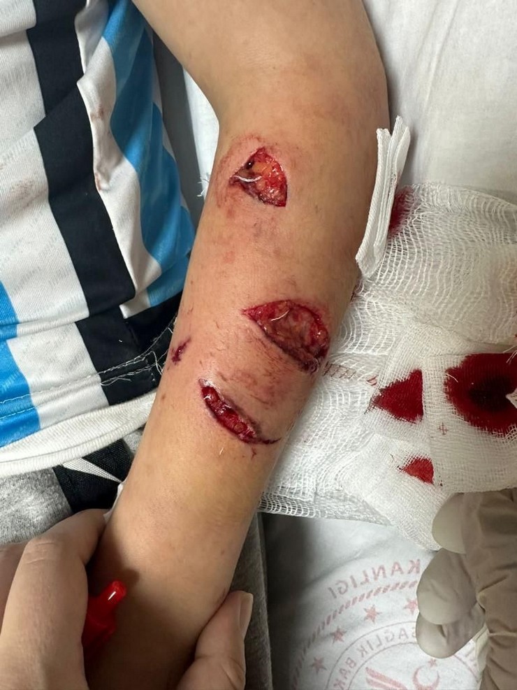 rizede-besleyip-sevdigi-basibos-kopegin-saldirisina-ugrayan-e-b-13-yaralandi.jpg