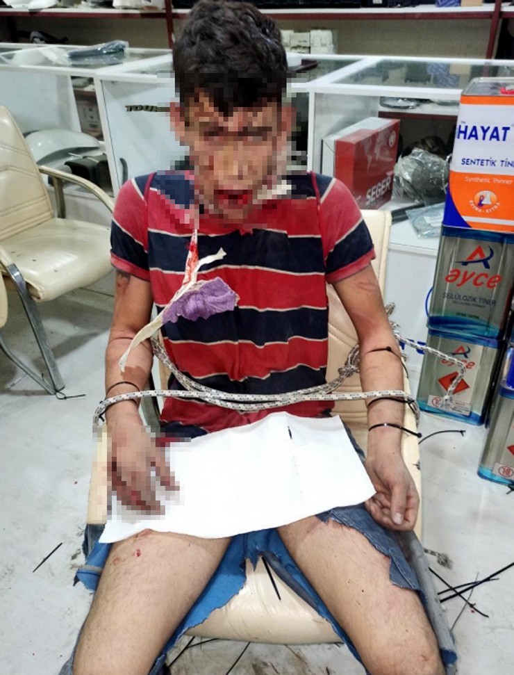 antalyada-calistigi-is-yerinde-70-bin-lirayi-bulan-birikmis-maasi-alamadigi-icin-patronuna-ait-masadaki-15-bin-lirayi-aldigi-gerekcesiyle-alikonulan-vedat-k-25-3-gun-darbedildi-bocek-yedirildi-disleri.jpg