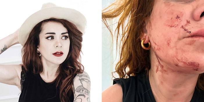 Taksim'de Merdivenlerde Oturan İki Arkadaşa Çivili Sopa ve Şişelerle Saldırdılar